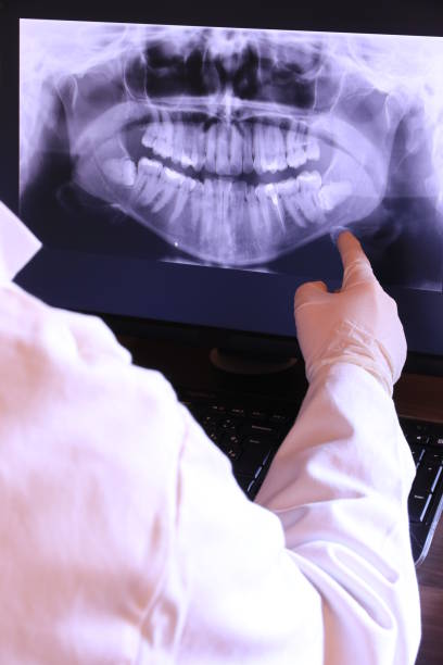 Best Emergency Tooth Extraction in Pineville, KY
