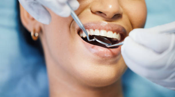 Best Emergency Broken Tooth Repair in Pineville, KY