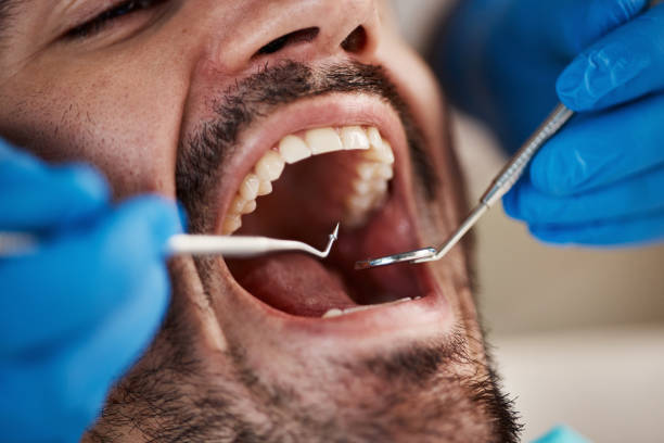 Best Emergency Root Canal Treatment in Pineville, KY